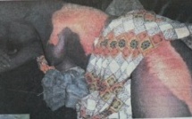 Tambacounda : La "Niarël" déverse une marmite d’eau chaude sur sa coépouse, son époux muni d’un bâton se rue sur la victime