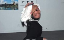 [Vidéo] Il vit avec un cou à l’envers – Regardez