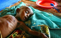 Tambacounda : La malnutrition, un mal bien présent