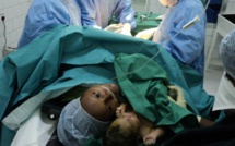 Stop aux césariennes inutiles