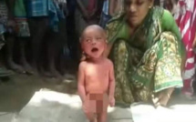 Inde : Un bébé de deux jours forcé à marcher, tenu par la tête