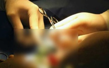 Un boxeur coupe le pénis de l'amant de sa femme avec un sécateur et le jette dans les toilettes avant de tirer la chasse