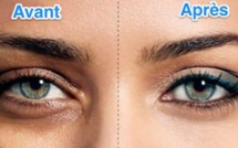 7 astuces naturelles anticernes