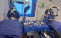 District sanitaire de Sangalkam : Plus de 1 500 patients opérés de la cataracte