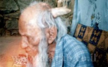 L'homme de 160 ans avec une corne à la tête