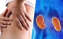 6 signes qui montrent que les reins ne sont pas en bonne santé
