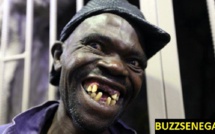 Concours d'homme le plus laid....au Zimbabwe 