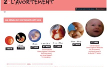 Sur l’idée selon laquelle «avant les 120 jours, l’Islam permet l’avortement », Imam Ismaila Ndiaye martèle : «tuer la vie à 120 jours, avant ou après 120 jours est interdit par l’islam »