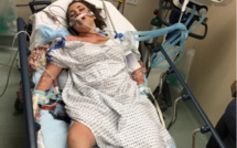 La terrible photo de cette étudiante nous alerte sur les dangers de l’alcool