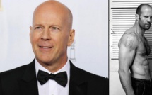 On sait enfin pourquoi on perd nos cheveux : les résultats de cette étude sont surprenants !