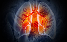Ziguinchor : 420 cas de tuberculose en six mois, l’alerte est donnée
