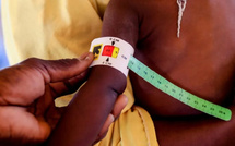 La malnutrition provoque une forme distincte de diabète, concluent des experts mondiaux