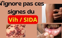 Contact avec une personne vivant avec le VIH : Que faire concrètement et sans paniquer ?