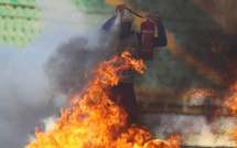 Louga : un homme de 30 ans meurt après s’être immolé par le feu