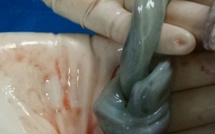 Un papa poste cette photo choc du cordon ombilical de son bébé