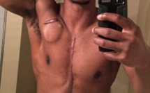 Vidéo : L’histoire émouvante d’un bodybuilder de 26 ans qui porte son cœur dans un sac à dos